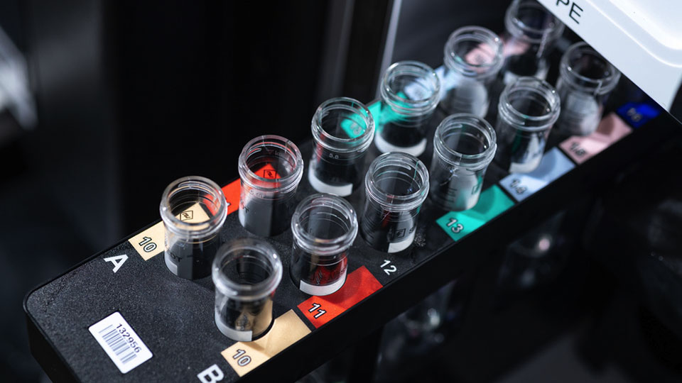 A close-up view of a laboratory rack holding rows of labeled test tubes under bright lighting.